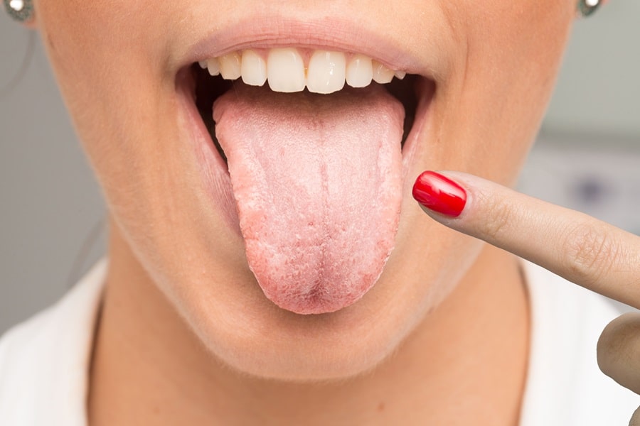 Your Tongue