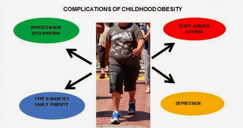Understanding Childhood Obesity: Prevention And Management