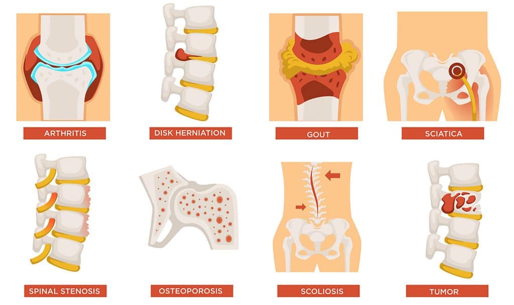 Bones, Joints, And Beyond: A Deep Dive Into Skeletal Health