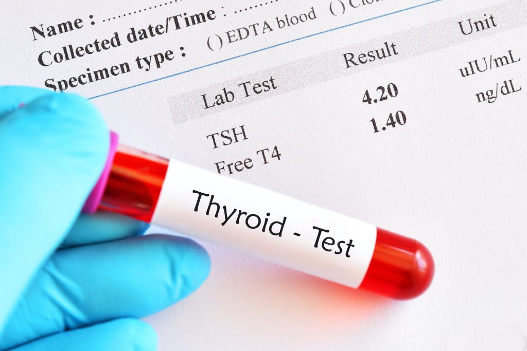 How To Test For Thyroid Issues At Home