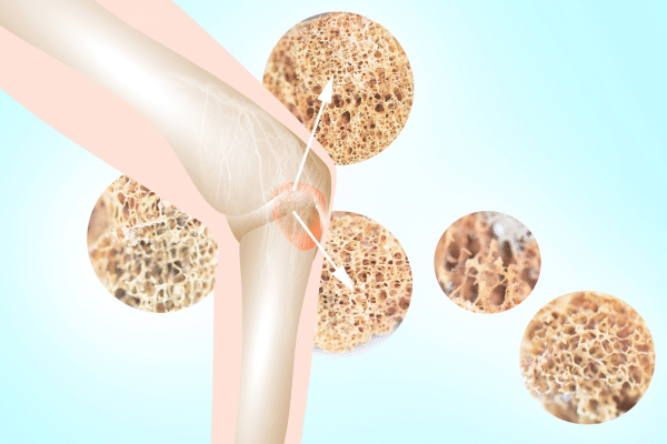 How Carbonated Drinks May Be Bad For You