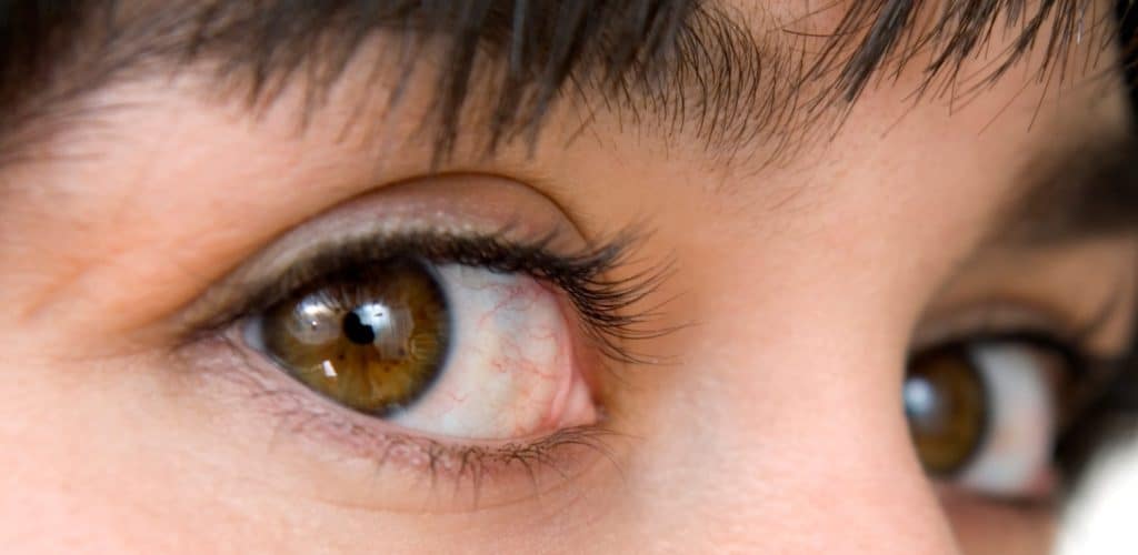 8 Tips For Proper Contact Lens Care And Hygiene
