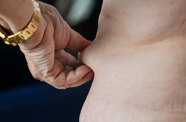 Dangers of High Cholesterol Levels