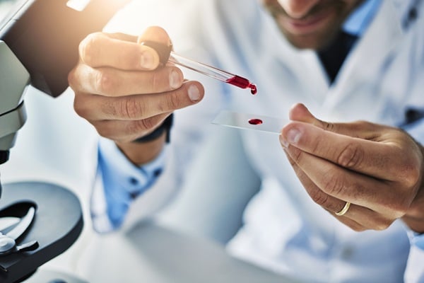 Dangers of High Cholesterol Levels