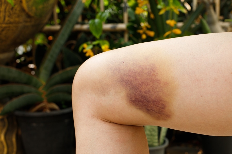 Weird Skin Changes That Might Point to Serious Issues