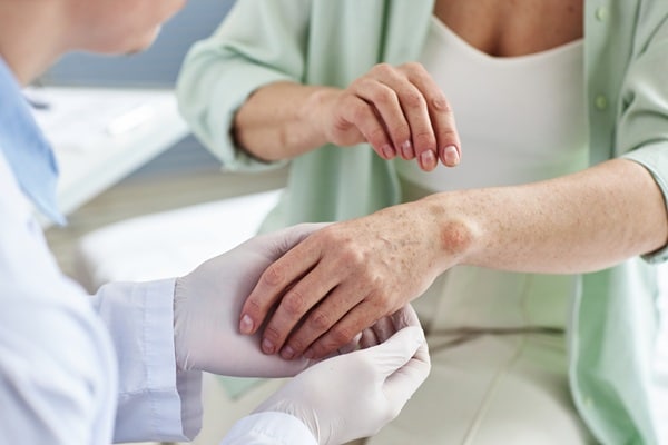 Weird Skin Changes That Might Point to Serious Issues