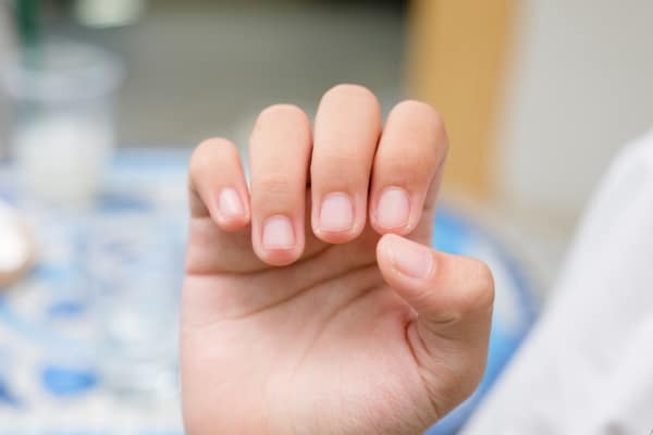What Your Fingernails Say About Your Health